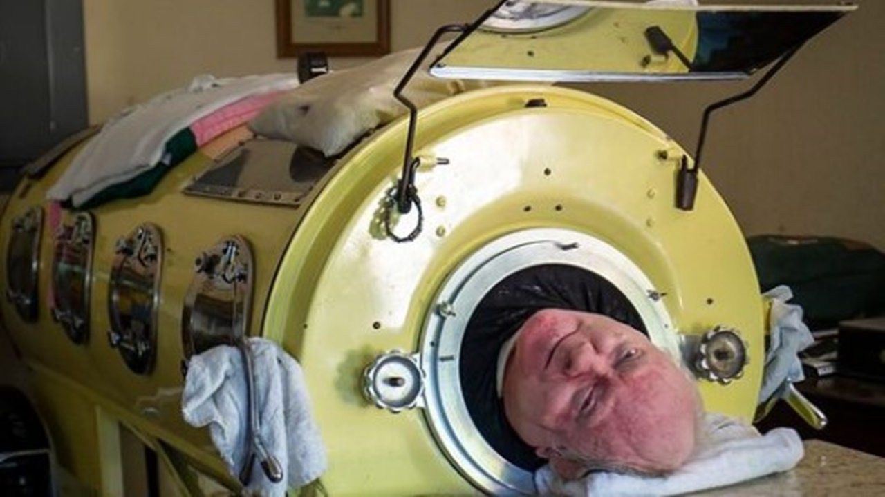Demir akciğer makinesinde geçen koskoca 72 yıl! Paul Alexander hayatını kaybetti