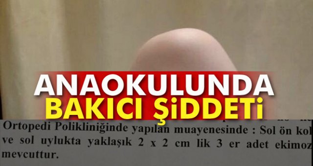 Anaokulunda bakıcı anne şiddeti