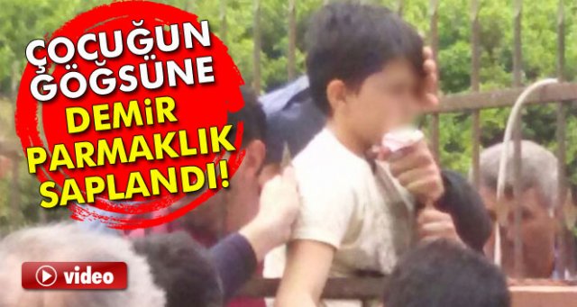 Çocuğun göğsüne demir parmaklık saplandı