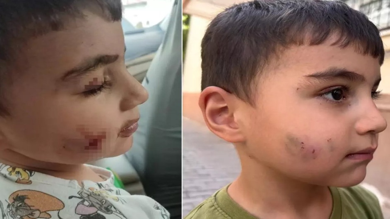 Ankara’da Dehşet: Lağım Faresi Evde Uyuyan Çocuğa Saldırdı
