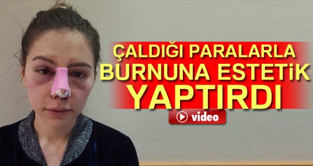 Çaldığı paralarla burnuna estetik yaptırdı