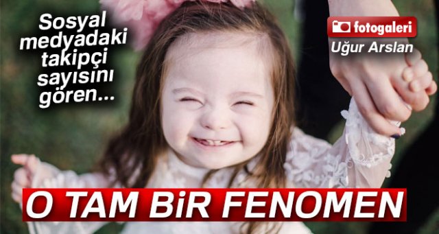 Down sendromlu İnci tam bir fenomen